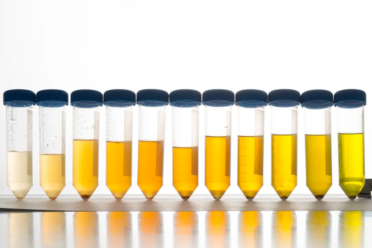 asperges urine glass