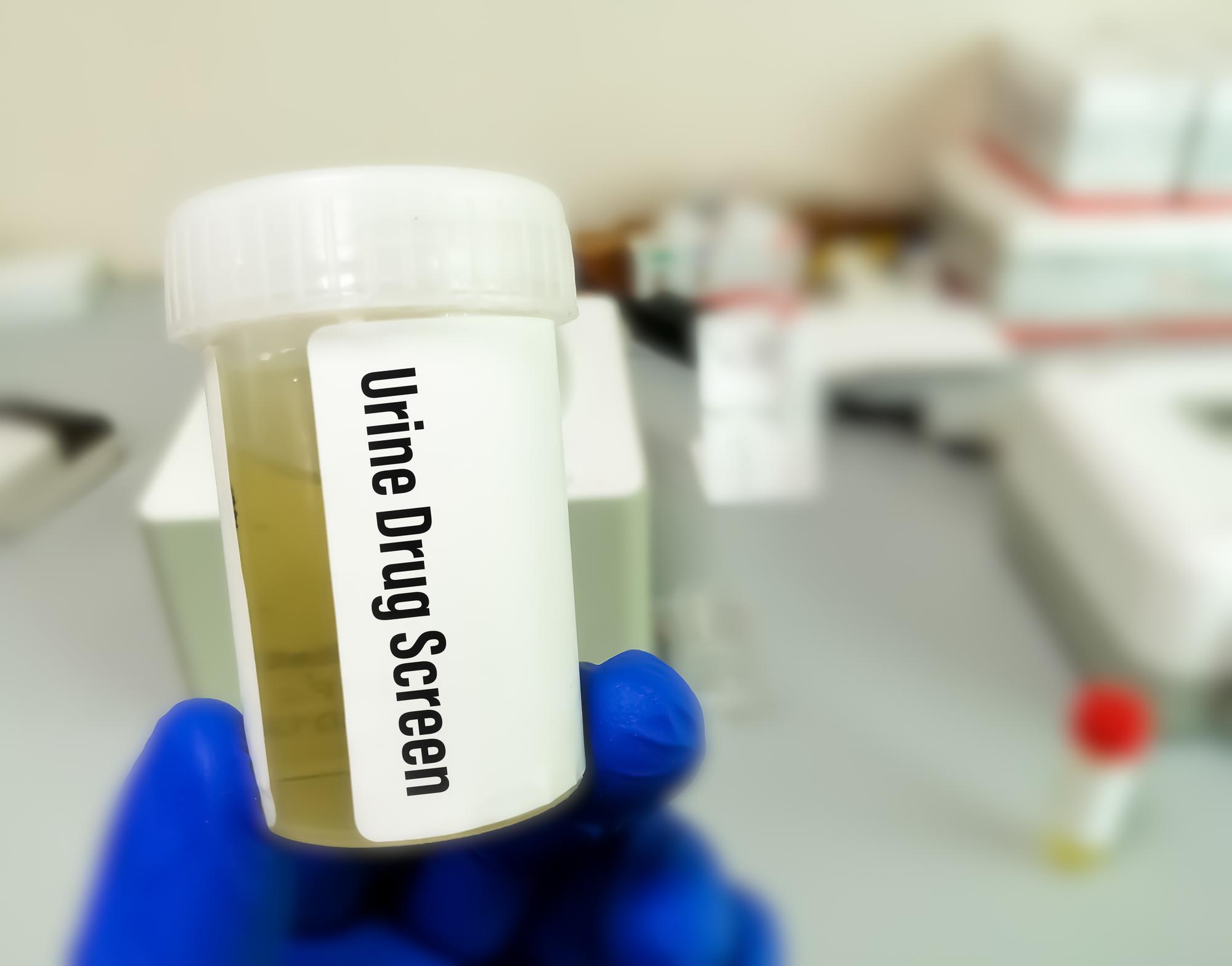 Quand faut-il s’inquiéter d’une urine qui sent fort ?