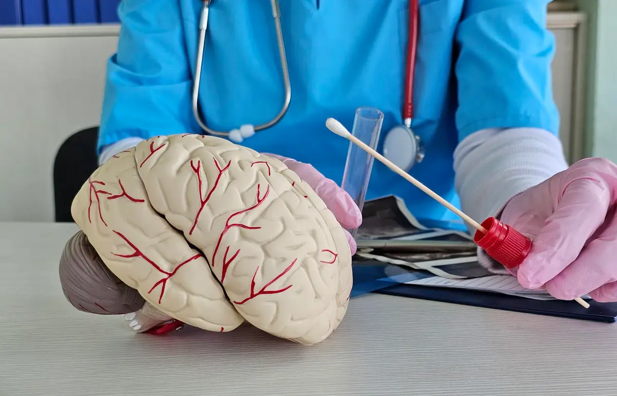 brain artery emergency