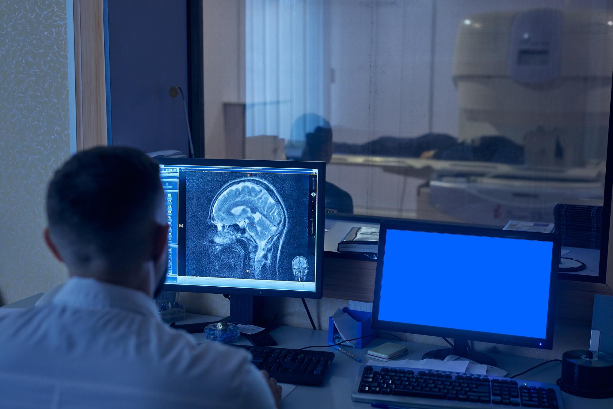 Comment différencier un AVC d’une rupture d’anévrisme ?