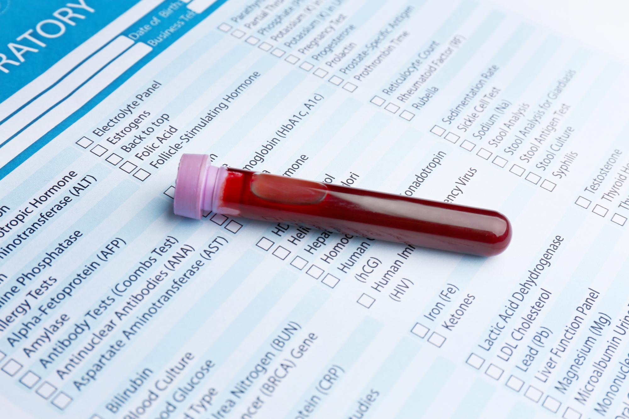 Comment rester serein face à un taux de B12 trop élevé ?