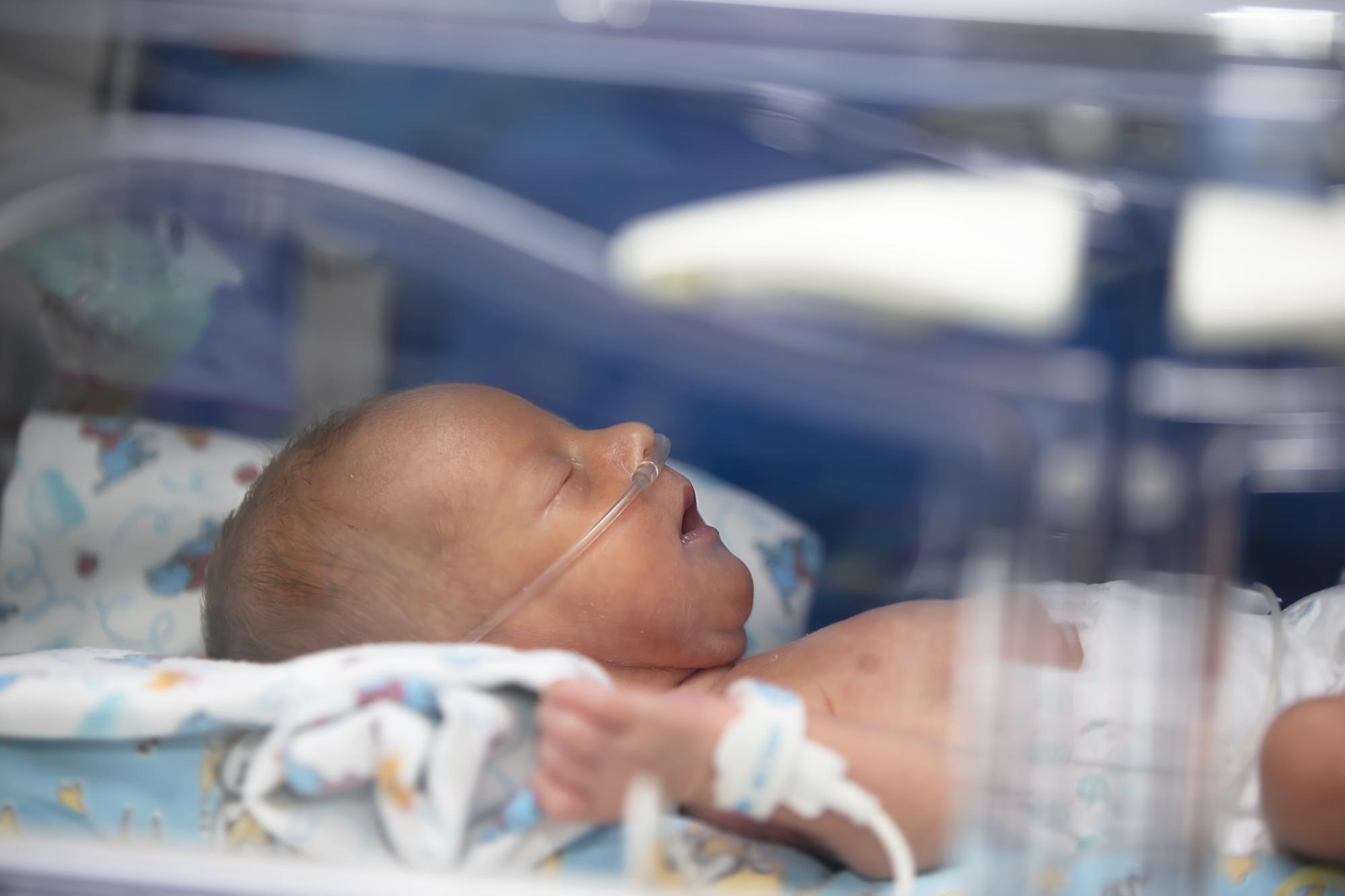À quoi correspond un bébé prématuré de 28 semaines ?